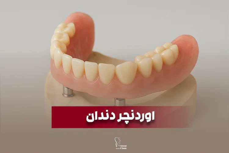 اوردنچر دندان مشهد