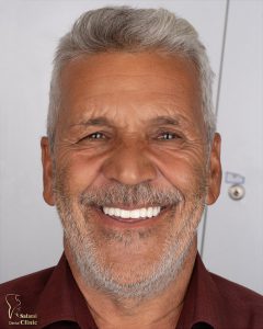 ایمپلنت دندان مشهد