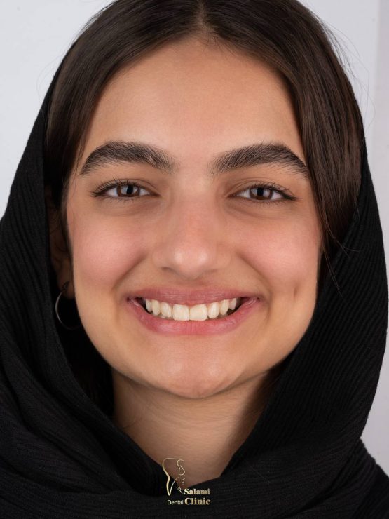 ارتودنسی دندان در مشهد