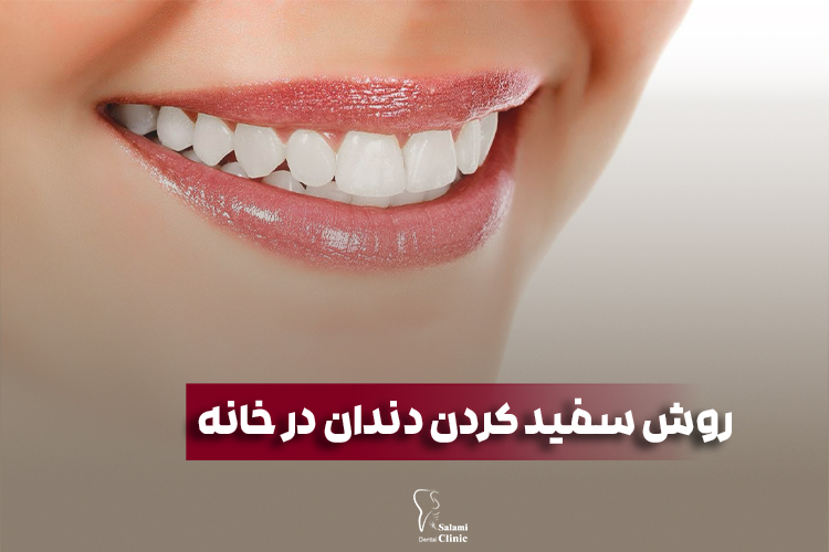 روش های خانگی سفید کردن دندان