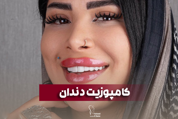 کامپوزیت دندان در مشهد