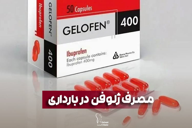 ریختن ژلوفن روی دندان در بارداری